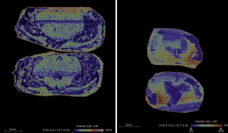 USP reforça que o consumo de pipoca de micro-ondas em excesso pode causar Alzheimer - Jornal O São Paulo