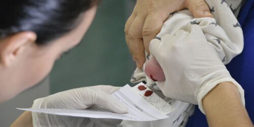 Dois anos após nova lei, teste do pezinho está em expansão no País - Jornal O São Paulo