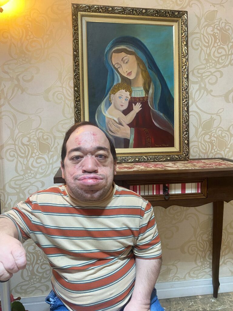 A resiliência dos raros e de suas famílias - Jornal O São Paulo