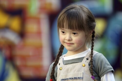 Japão: Uma nova esperança no tratamento da síndrome de Down  - Jornal O São Paulo