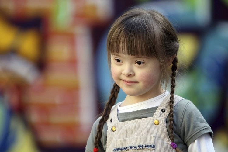 Japão: Uma nova esperança no tratamento da síndrome de Down  - Jornal O São Paulo