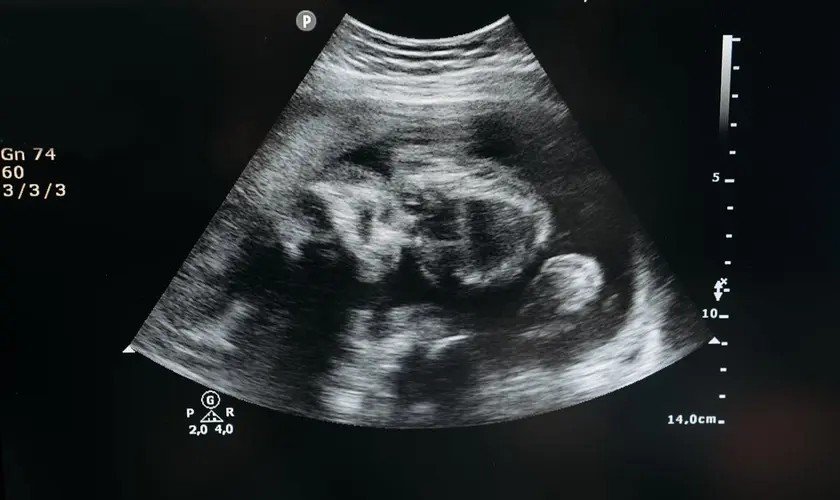 Porto Rico: nascituros passam a ser reconhecidos como pessoas naturais desde a concepção - Jornal O São Paulo