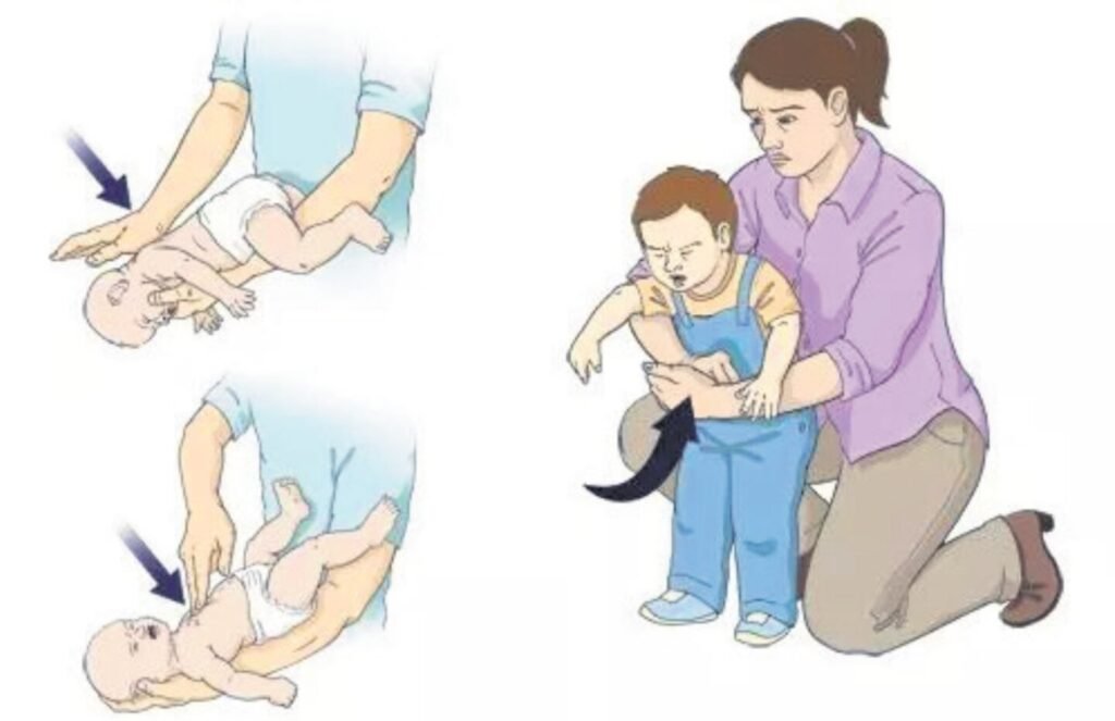 E se alguém se engasgar perto de você, o que fazer? - Jornal O São Paulo