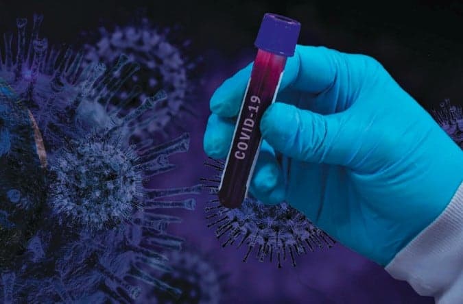 Com avanços nos testes, CoronaVac pode ser a primeira vacina contra a COVID-19 no Brasil - Jornal O São Paulo