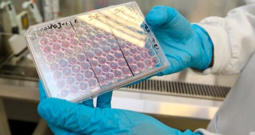 Unicamp desenvolve aditivo para tintas que inativa o coronavírus - Jornal O São Paulo