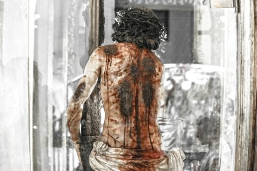 ‘Por Suas feridas fomos curados’ (1Pd 2, 24) - Jornal O São Paulo