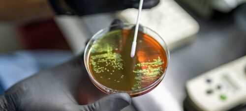OMS atualiza lista de bactérias que mais ameaçam a saúde humana - Jornal O São Paulo
