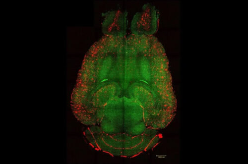 Suíça: nanofiltro sanguíneo remove proteínas da doença de Alzheimer em poucas horas, revertendo a demência  - Jornal O São Paulo
